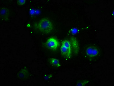 CDH1 / E Cadherin Antibody - Immunofluorescence staining of MCF-7 cells with CDH1 Antibody at 1:100, counter-stained with DAPI. The cells were fixed in 4% formaldehyde, permeabilized using 0.2% Triton X-100 and blocked in 10% normal Goat Serum. The cells were then incubated with the antibody overnight at 4°C. The secondary antibody was Alexa Fluor 488-congugated AffiniPure Goat Anti-Rabbit IgG(H+L).