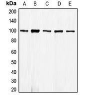 CDH1 / E Cadherin Antibody - Western blot analysis of E Cadherin expression in HEK293T (A); A431 (B); MCF7 (C); mouse kidney (D); rat kidney (E) whole cell lysates.
