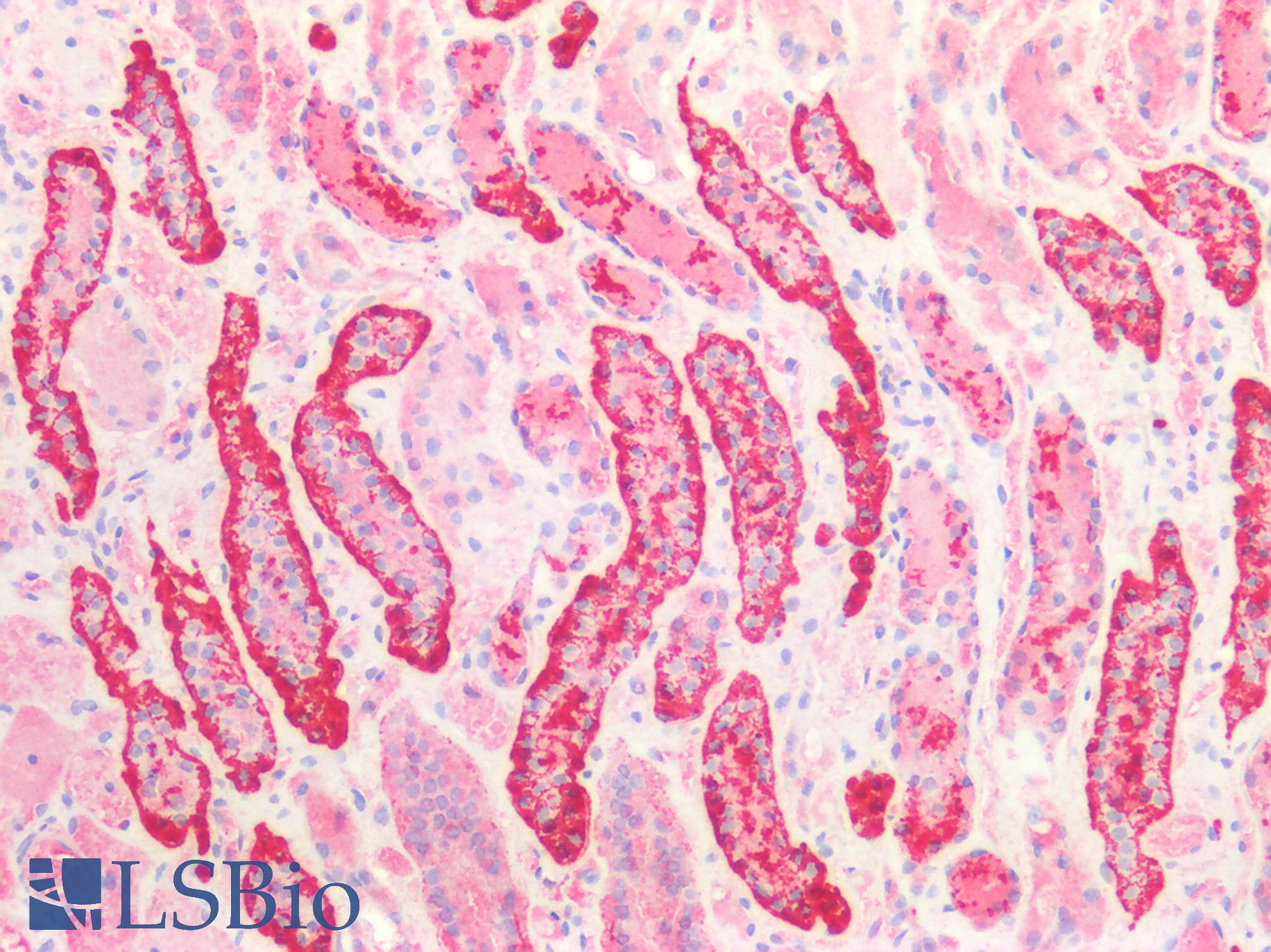CDH16 / Cadherin 16 Antibody - Human Kidney: Formalin-Fixed, Paraffin-Embedded (FFPE)