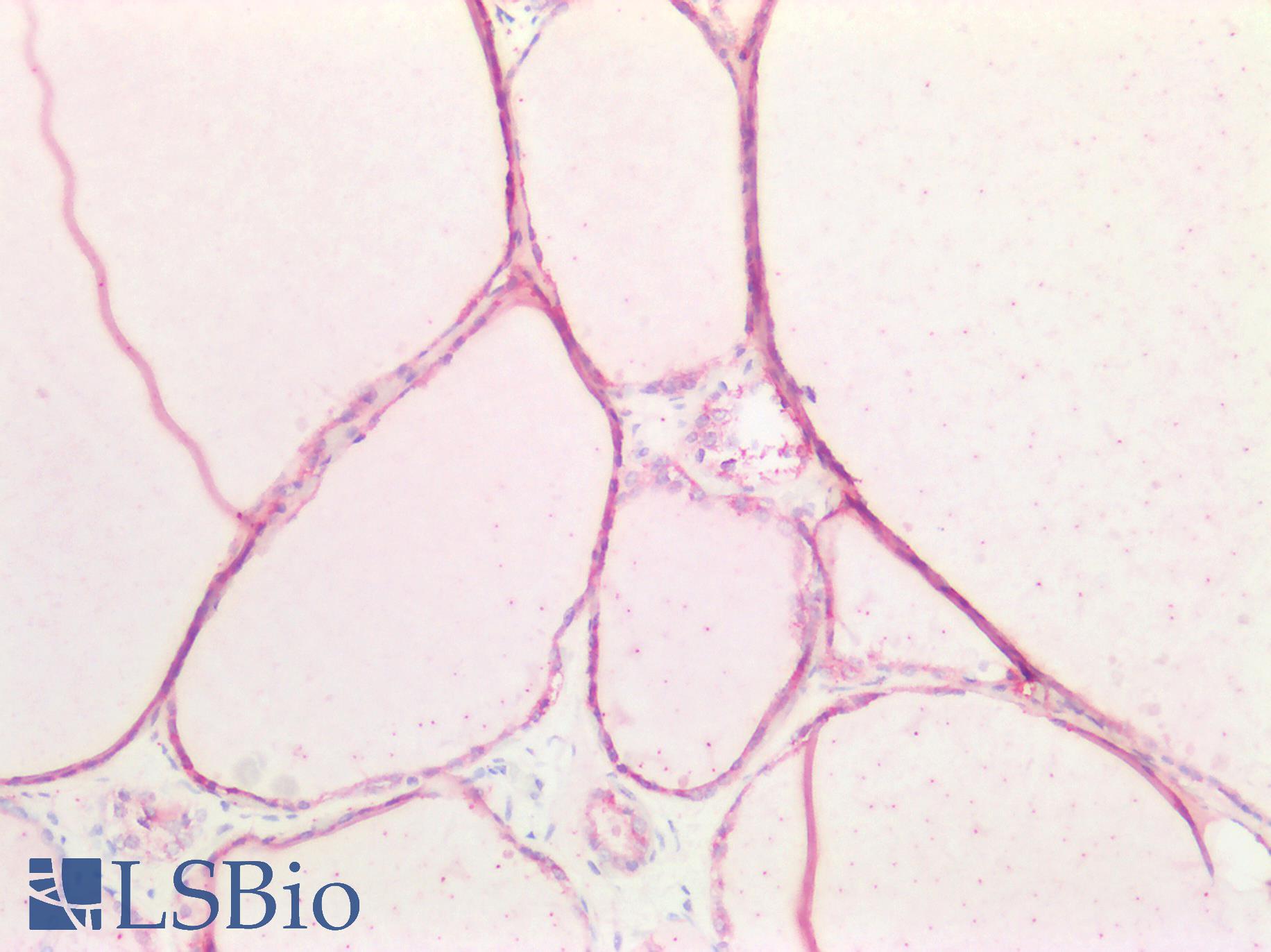 CDH16 / Cadherin 16 Antibody - Human Thyroid: Formalin-Fixed, Paraffin-Embedded (FFPE)