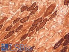 CDH16 / Cadherin 16 Antibody - Human Kidney: Formalin-Fixed, Paraffin-Embedded (FFPE)