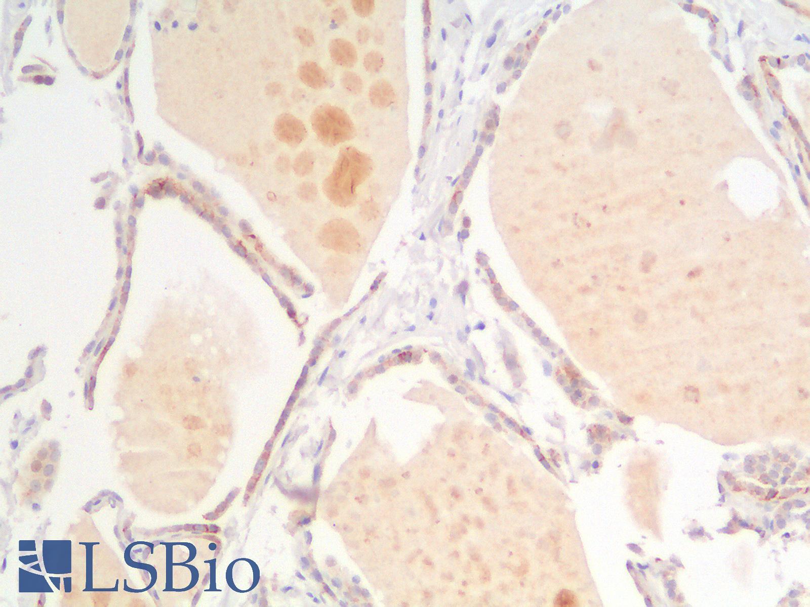 CDH16 / Cadherin 16 Antibody - Human Thyroid: Formalin-Fixed, Paraffin-Embedded (FFPE)