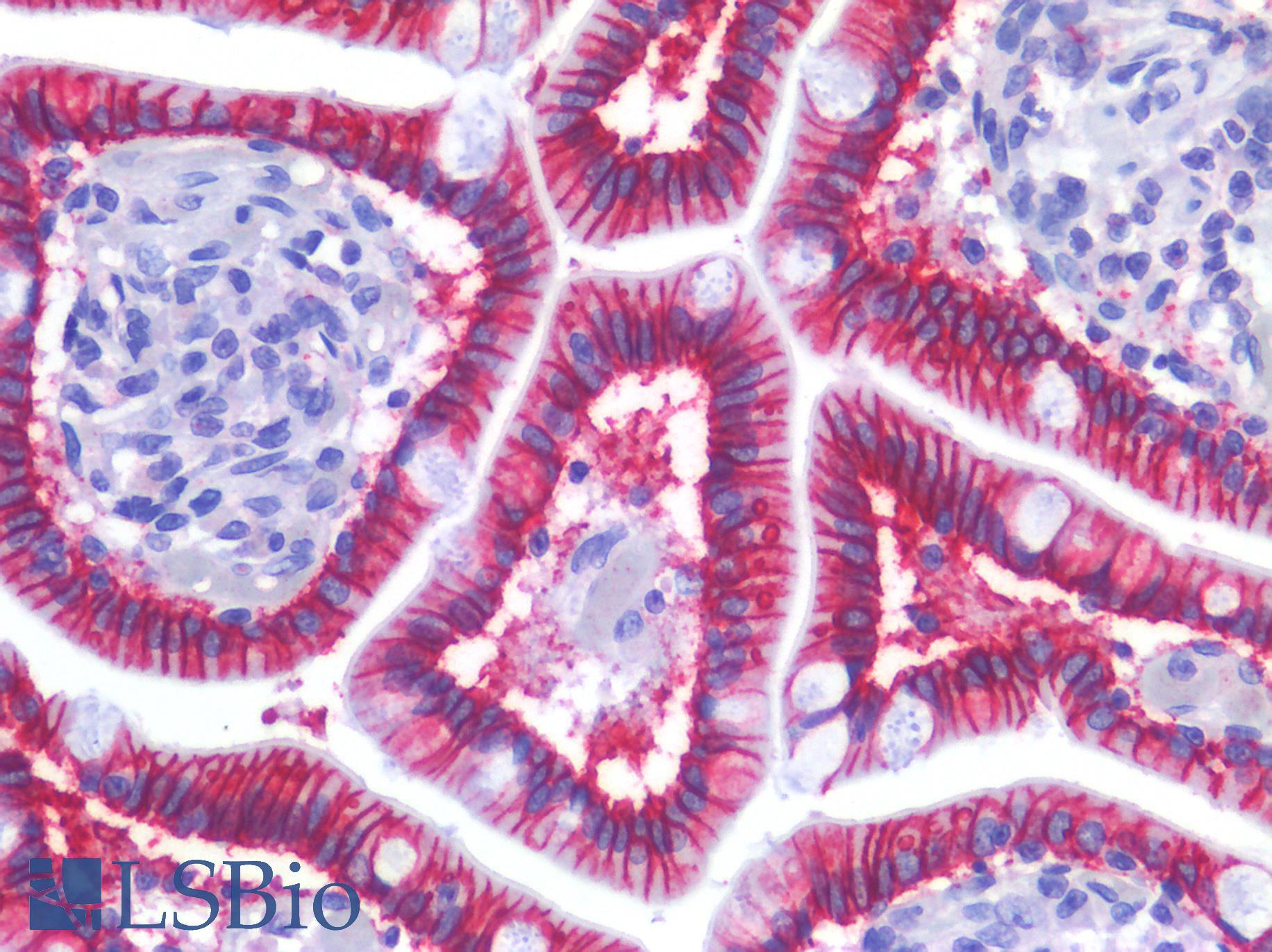CDH17 / Cadherin 17 Antibody - Human Small Intestine: Formalin-Fixed, Paraffin-Embedded (FFPE)