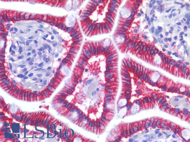CDH17 / Cadherin 17 Antibody - Human Small Intestine: Formalin-Fixed, Paraffin-Embedded (FFPE)