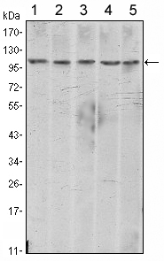 CDH2 / N Cadherin Antibody - Western blot using CDH2 mouse monoclonal antibody against A431 (1), NIH/3T3 (2), HeLa (3), C6 (4) and LNCap (5) cell lysate.