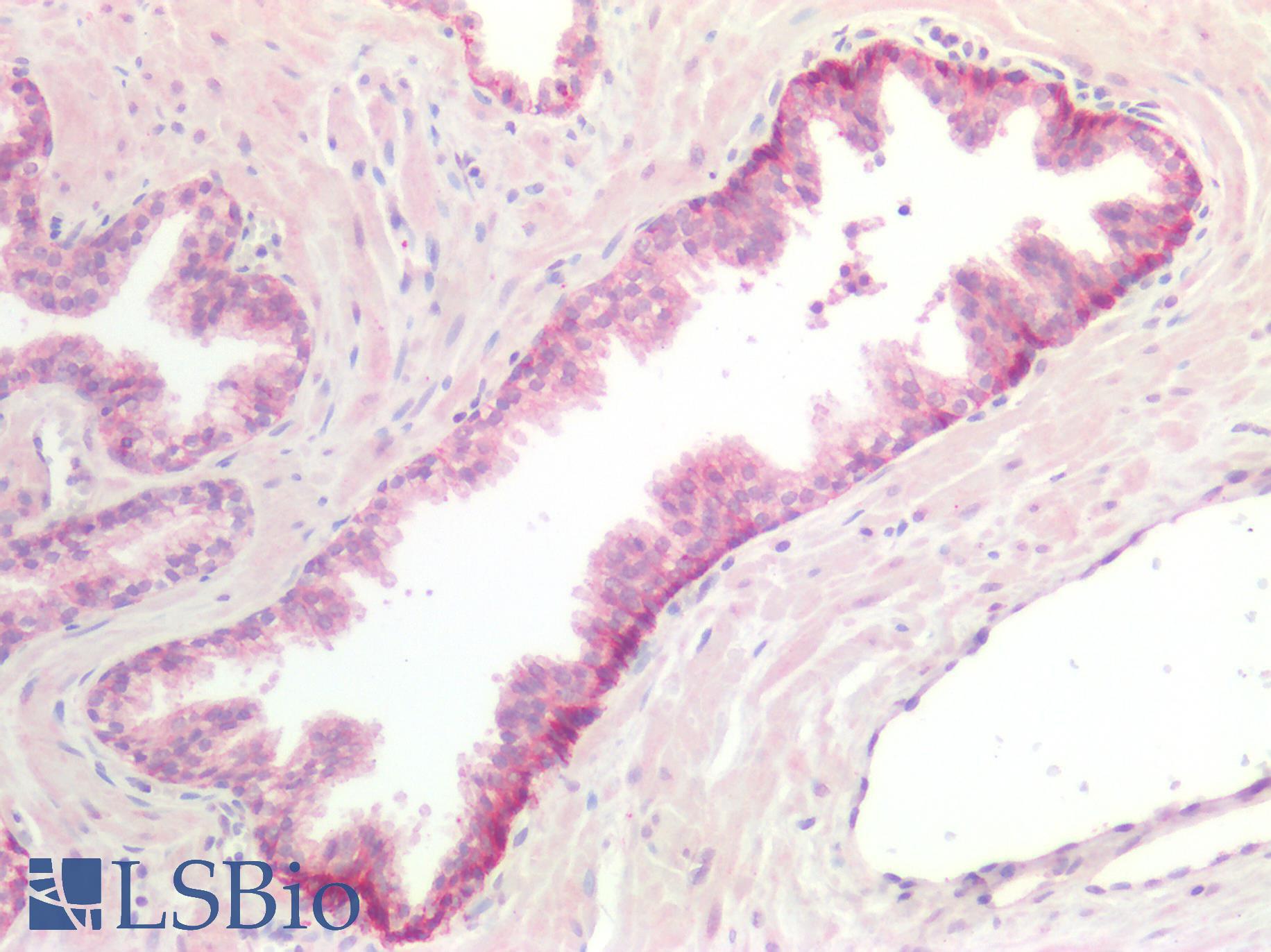 CDH3 / P-Cadherin Antibody - Human Prostate: Formalin-Fixed, Paraffin-Embedded (FFPE)