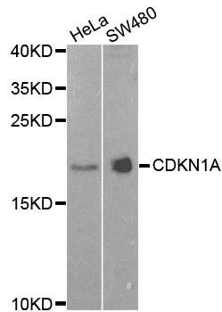 CDKN1A / WAF1 / p21 Antibody - Western blot blot of extracts of various cell lines, using CDKN1A antibody.