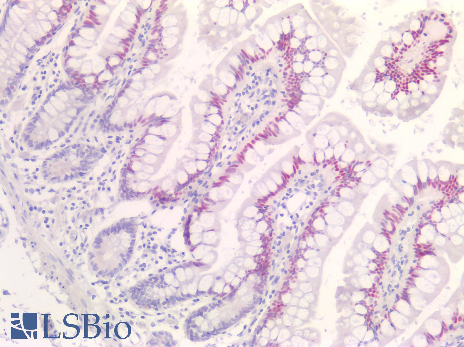 CDKN1A / WAF1 / p21 Antibody - Human Small Intestine: Formalin-Fixed, Paraffin-Embedded (FFPE)