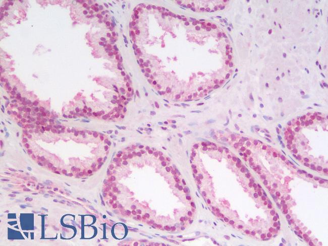 CDKN1B / p27 Kip1 Antibody - Human Prostate: Formalin-Fixed, Paraffin-Embedded (FFPE)