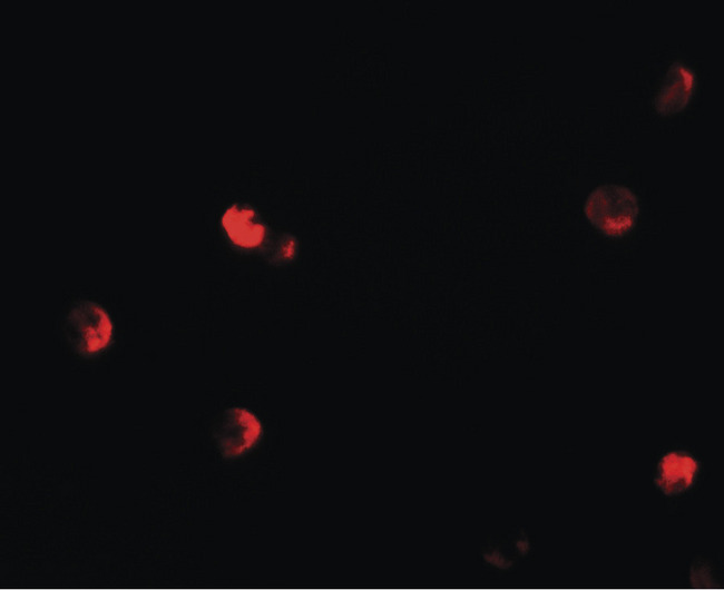 CDKN1C / p57 Kip2 Antibody - Immunofluorescence of CDKN1C in 293 cells with CDKN1C antibody at 20 ug/ml.