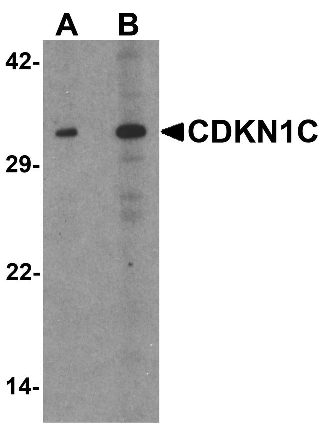 CDKN1C / p57 Kip2 Antibody - Western blot analysis of CDKN1C in 293 cell lysate with CDKN1C antibody at (A) 1 and (B) 2 ug/ml.