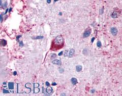 CELSR2 Antibody - Brain, Alzheimer's disease neurofibrillary tangle
