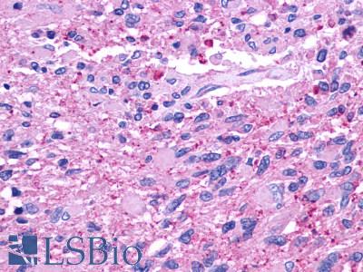CELSR2 Antibody - Brain, Glioblastoma