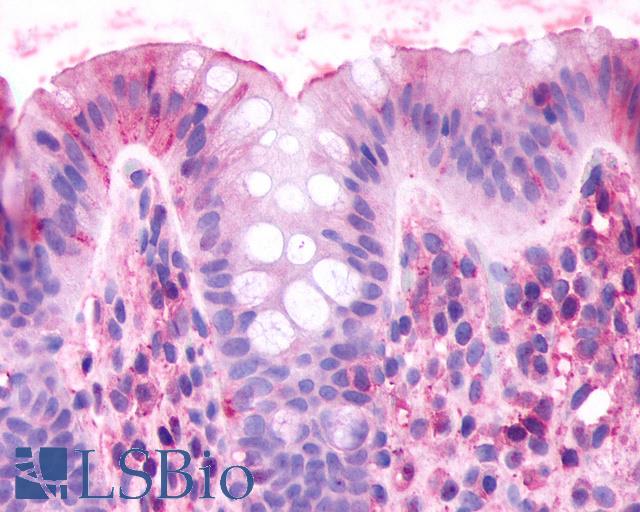 CELSR2 Antibody - Anti-CELSR2 antibody IHC of human colon. Immunohistochemistry of formalin-fixed, paraffin-embedded tissue after heat-induced antigen retrieval.