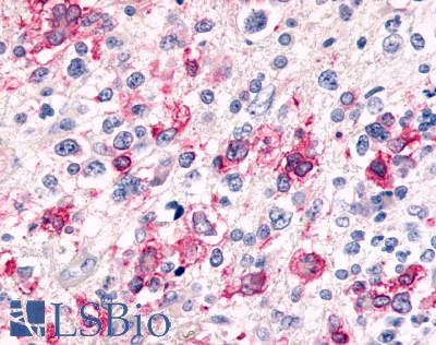 CELSR3 Antibody - Brain, Glioblastoma