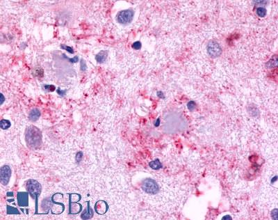 CELSR3 Antibody - Brain, Alzheimer's, amyloid cores within senile plaques