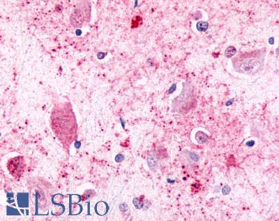CELSR3 Antibody - Brain, Amygdala, neurons and glia