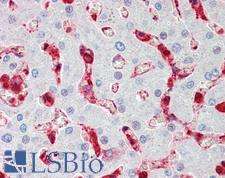 CFL1 / Cofilin Antibody - Anti-CFL1 / Cofilin antibody IHC staining of human liver. Immunohistochemistry of formalin-fixed, paraffin-embedded tissue after heat-induced antigen retrieval.
