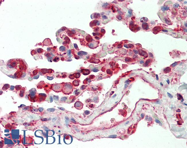 CFL1 / Cofilin Antibody - Anti-CFL1 / Cofilin antibody IHC staining of human lung. Immunohistochemistry of formalin-fixed, paraffin-embedded tissue after heat-induced antigen retrieval.