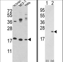 CFL1 / Cofilin Antibody - Western blot of CFL1 Antibody in MCF-7,HeLa cell line and mouse brain tissue lysates (35 ug/lane). CFL1 (arrow) was detected using the purified antibody.(2 ug/ml)