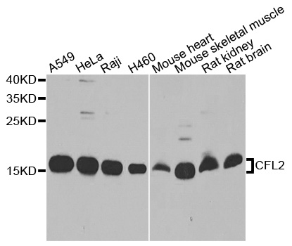 CFL2 / Cofilin 2 Antibody - Western blot analysis of extracts of various cells.