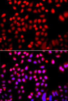 CFL2 / Cofilin 2 Antibody - Immunofluorescence analysis of A549 cells.