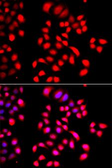 CFL2 / Cofilin 2 Antibody - Immunofluorescence analysis of A549 cells.