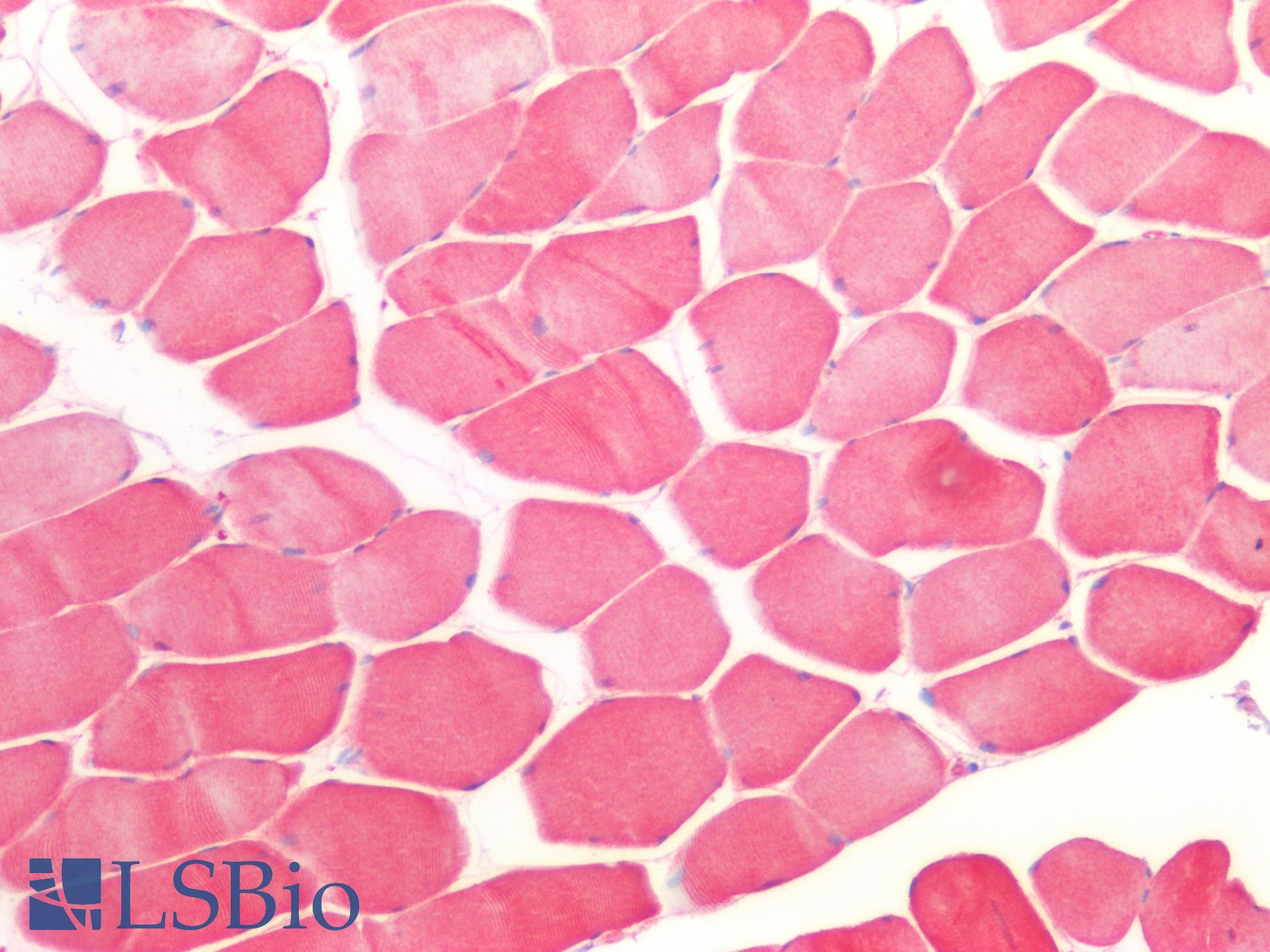 CFL2 / Cofilin 2 Antibody - Human Skeletal Muscle: Formalin-Fixed, Paraffin-Embedded (FFPE)