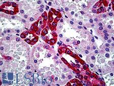 CFTR Antibody - Anti-CFTR antibody IHC of human kidney. Immunohistochemistry of formalin-fixed, paraffin-embedded tissue after heat-induced antigen retrieval. Antibody concentration 2.5 ug/ml.