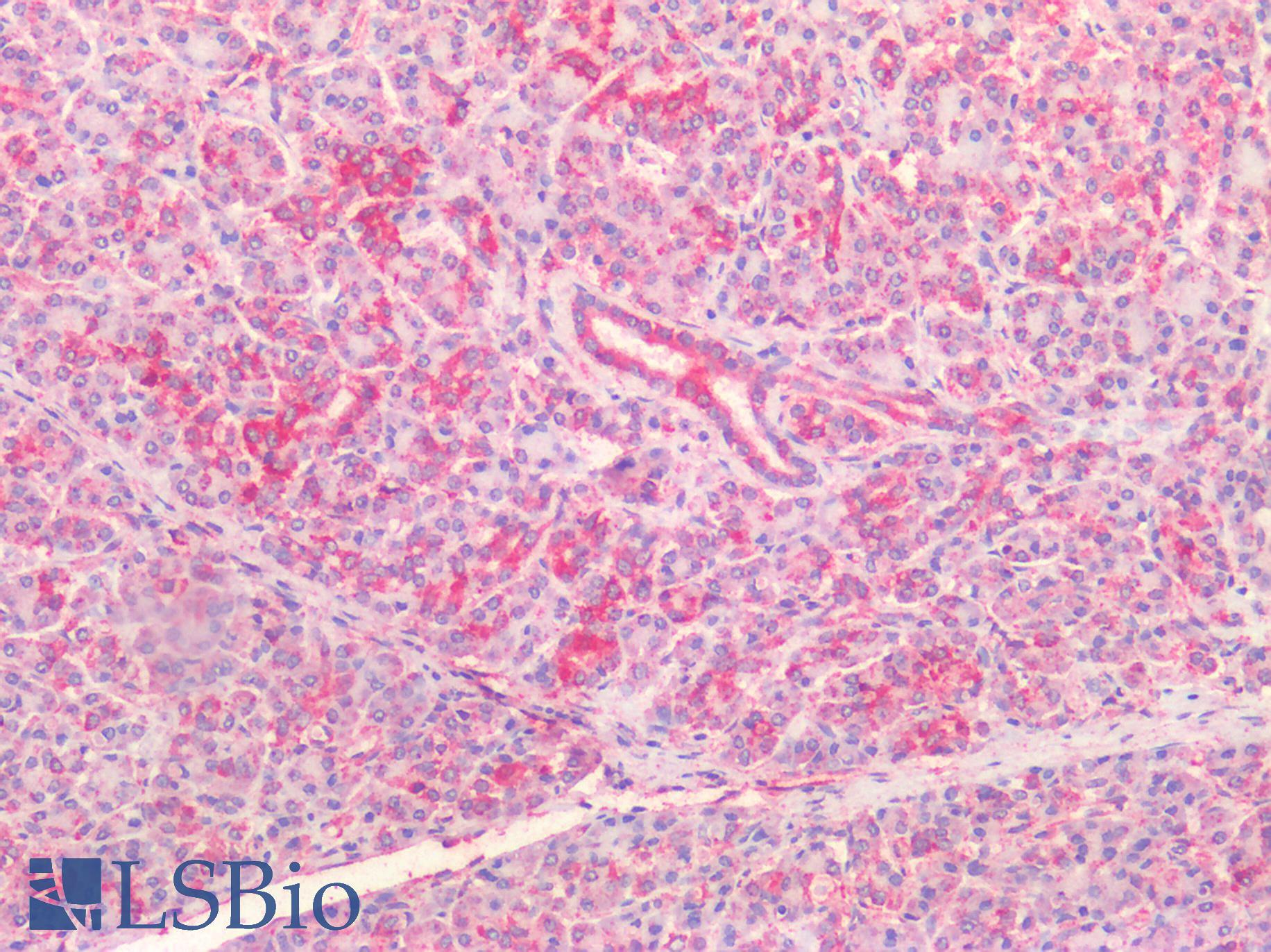 CFTR Antibody - Human Pancreas: Formalin-Fixed, Paraffin-Embedded (FFPE)