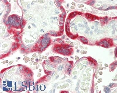 CGB / hCG Beta Antibody - Human Placenta, trophoblasts: Formalin-Fixed, Paraffin-Embedded (FFPE)