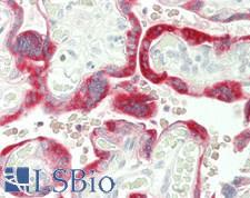 CGB / hCG Beta Antibody - Human Placenta, trophoblasts: Formalin-Fixed, Paraffin-Embedded (FFPE)