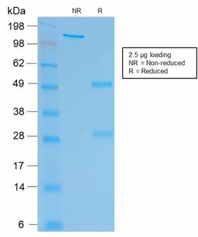 CGB / hCG Beta Antibody - SDS-PAGE Analysis Purified hCG beta Mouse Recombinant Monoclonal Antibody (rHCGb/54). Confirmation of Purity and Integrity of Antibody.