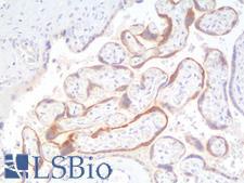 CGB / hCG Beta Antibody - Human Placenta: Formalin-Fixed, Paraffin-Embedded (FFPE)