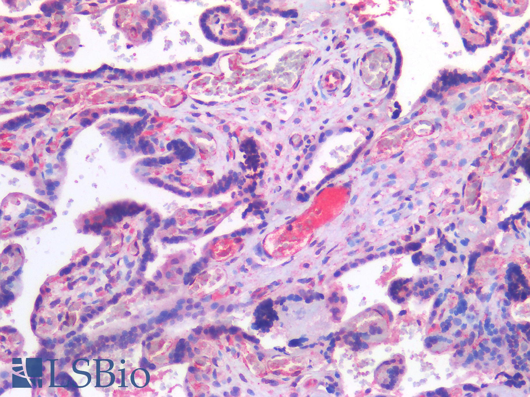CHAT Antibody - Human Placenta: Formalin-Fixed, Paraffin-Embedded (FFPE)