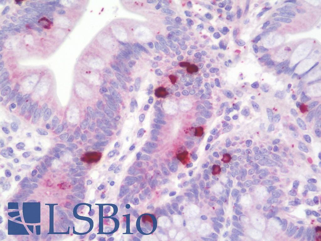 Ls B 0 Rabbit Anti Chat Antibody 98 128 Ihc Plus Clinisciences