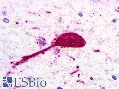 CHEMR23 / CMKLR1 Antibody - Brain, substantia nigra
