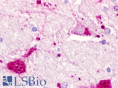CHEMR23 / CMKLR1 Antibody - Brain, Hypothalamus