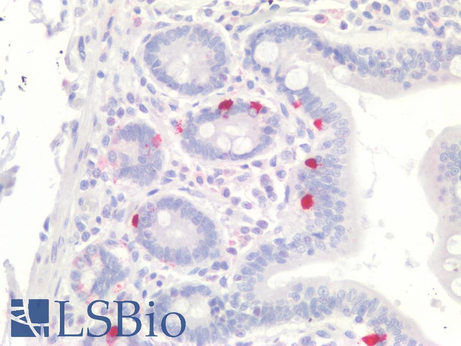 PathPlus™ CHGA / Chromogranin A Polyclonal Antibody Rabbit IHC | LSBio