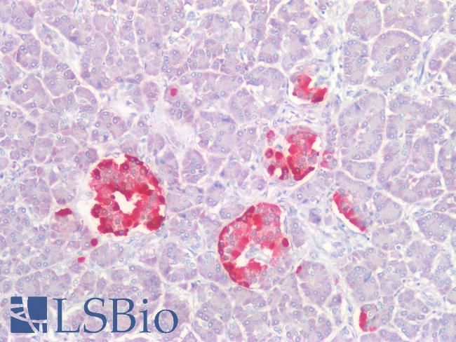 CHGA / Chromogranin A Antibody - Human Pancreatic Islets of Langerhans: Formalin-Fixed, Paraffin-Embedded (FFPE)