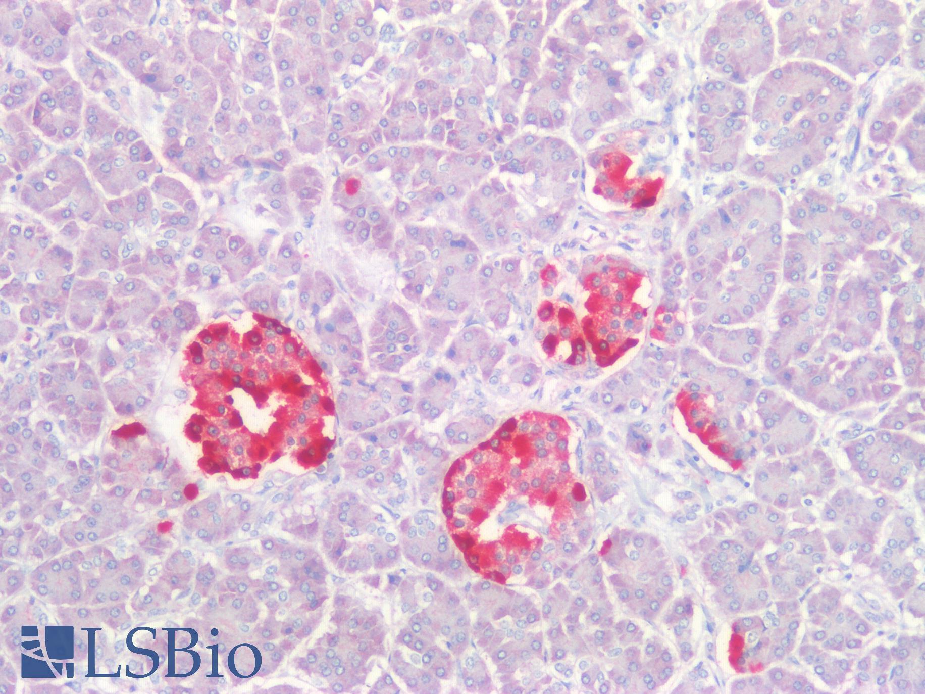 CHGA / Chromogranin A Antibody - Human Pancreatic Islets of Langerhans: Formalin-Fixed, Paraffin-Embedded (FFPE)