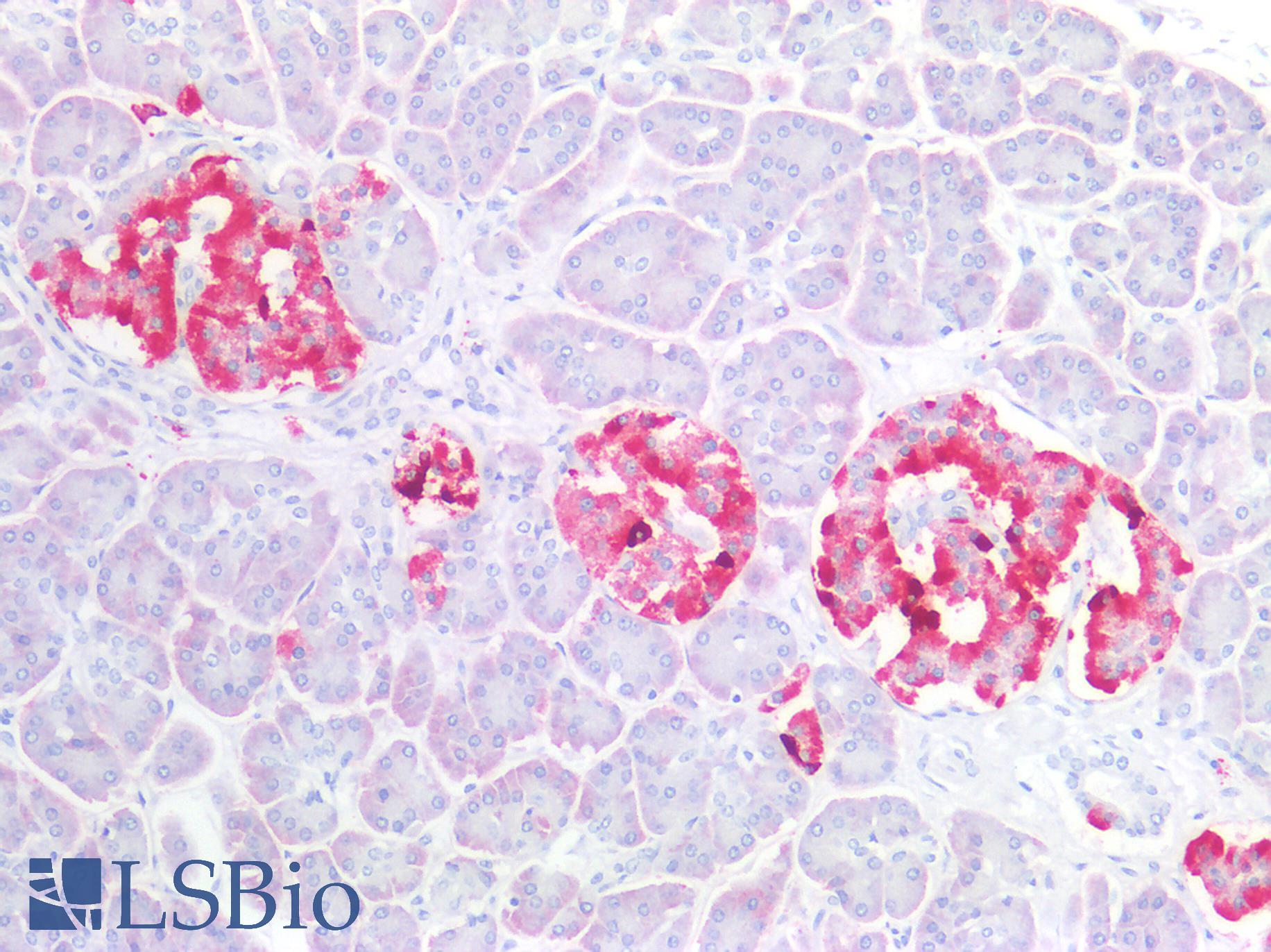 CHGA / Chromogranin A Antibody - Human Pancreas, Islets of Langerhans: Formalin-Fixed, Paraffin-Embedded (FFPE)