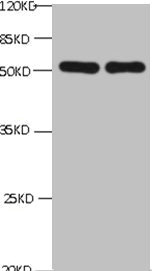 CHGA / Chromogranin A Antibody - All lanes: Chromogranin-A transfected E.coli lysate lane 1:Mouse Anti-6*his monoclonal antibody at 1ug/ml lane 2 : Mouse anti- Chromogranin-A monoclonal antibody at 1ug/ml Predicted band size : 52Kd Observed band size : 52kd