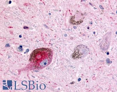 CHRM2 / M2 Antibody - Brain, Parkinson's Disease Neuron Lewy BodyBrain, Parkinson's Disease Neuron Lewy Body