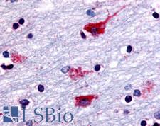 CHRM2 / M2 Antibody - Anti-CHRM2 antibody IHC of human brain, neurons and glia. Immunohistochemistry of formalin-fixed, paraffin-embedded tissue after heat-induced antigen retrieval.