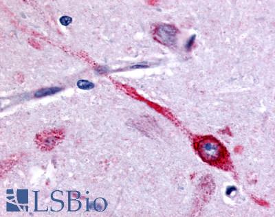 CHRM2 / M2 Antibody - Brain, Amygdala neuron