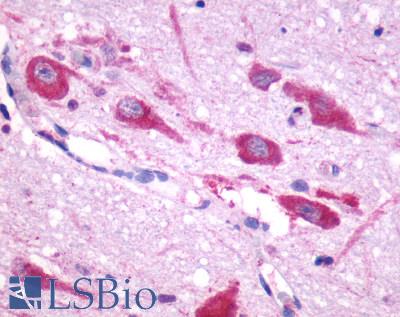 CHRM5 / M5 Antibody - Brain, Hypothalamus, Ventromedial nucleus