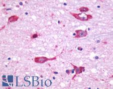 CHRM5 / M5 Antibody - Anti-CHRM5 antibody IHC of human brain, neurons and glia. Immunohistochemistry of formalin-fixed, paraffin-embedded tissue after heat-induced antigen retrieval.