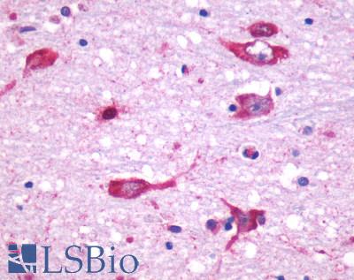 CHRM5 / M5 Antibody - Anti-CHRM5 antibody IHC of human brain, neurons and glia. Immunohistochemistry of formalin-fixed, paraffin-embedded tissue after heat-induced antigen retrieval.