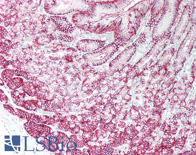 CLDN18 / Claudin 18 Antibody - Human Stomach: Formalin-Fixed, Paraffin-Embedded (FFPE)